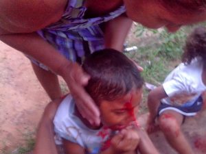 Acidente: Pai e filhos